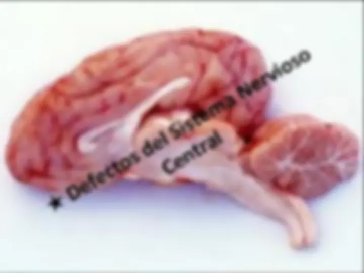 pf5