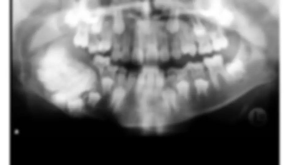 pf26