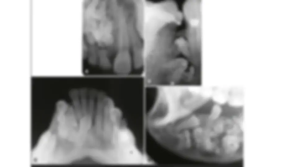 pf19