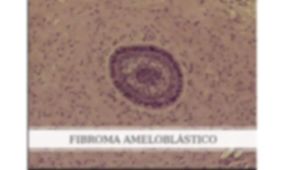 pf3