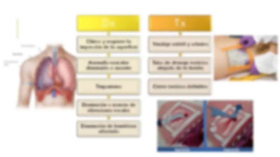 pf14