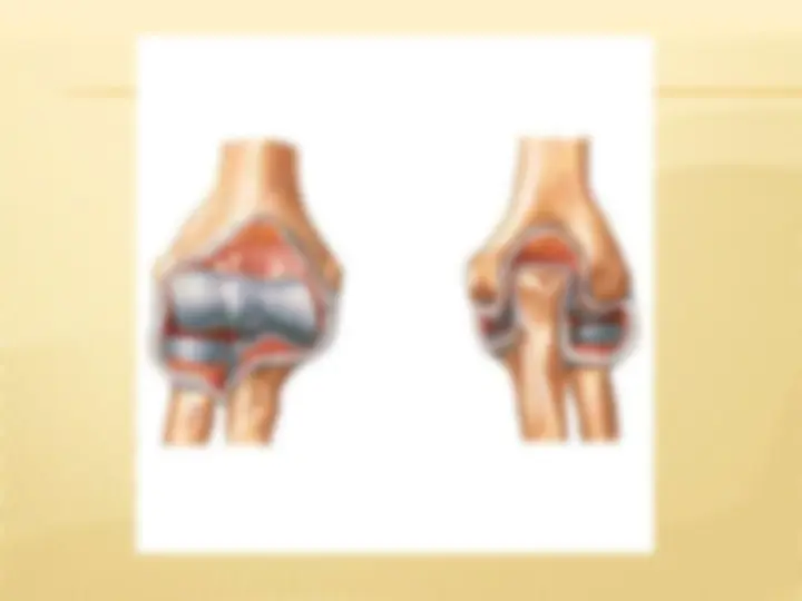 pf5