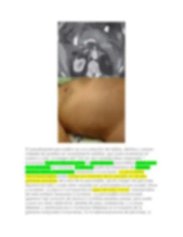 pf42