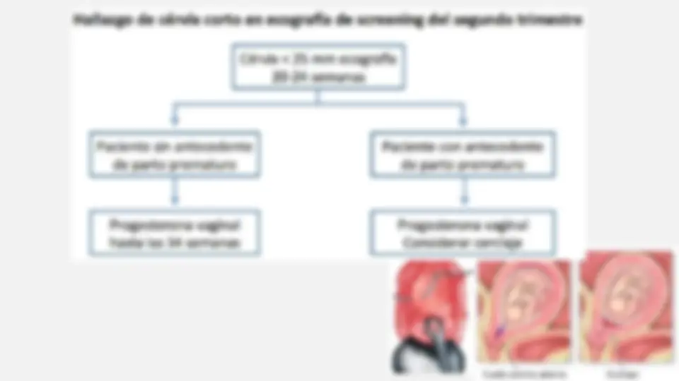 pfe