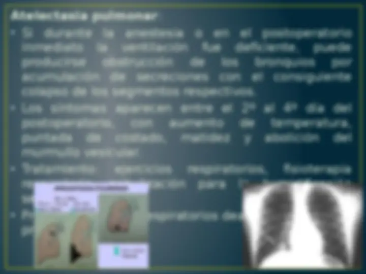 pf1a