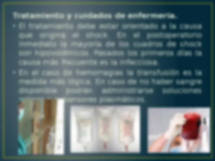 pfe