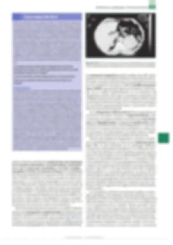 pf2e