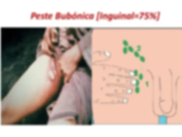 pf1a