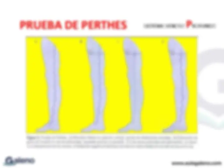 pf16