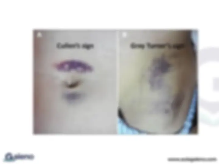 pf5