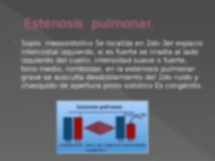 pf13
