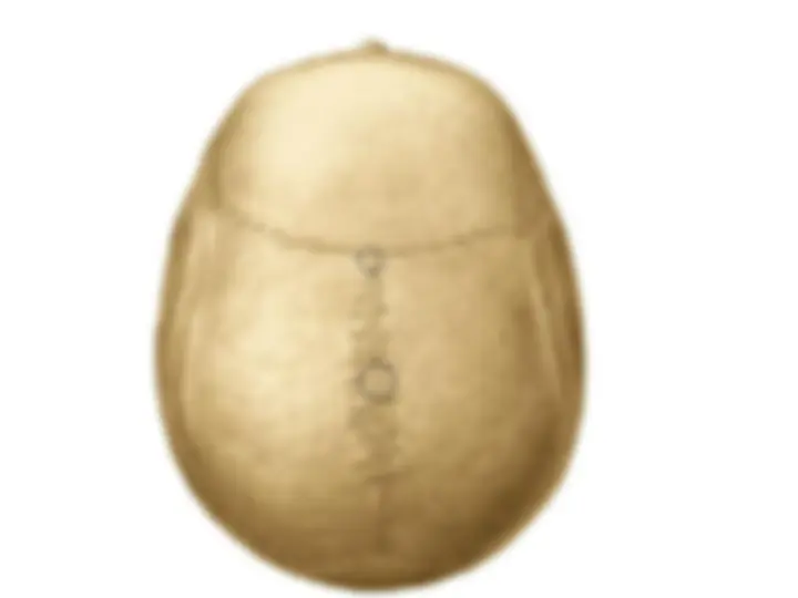 pf31