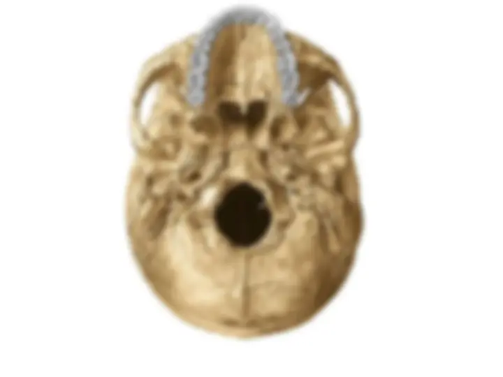 pf34