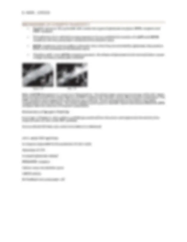 Synaptic Plasticity - LPT and LTD | Lecture notes Neuroscience | Docsity