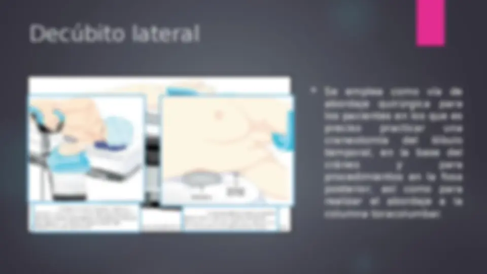pfa