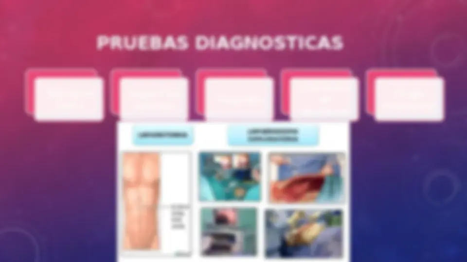 pfd