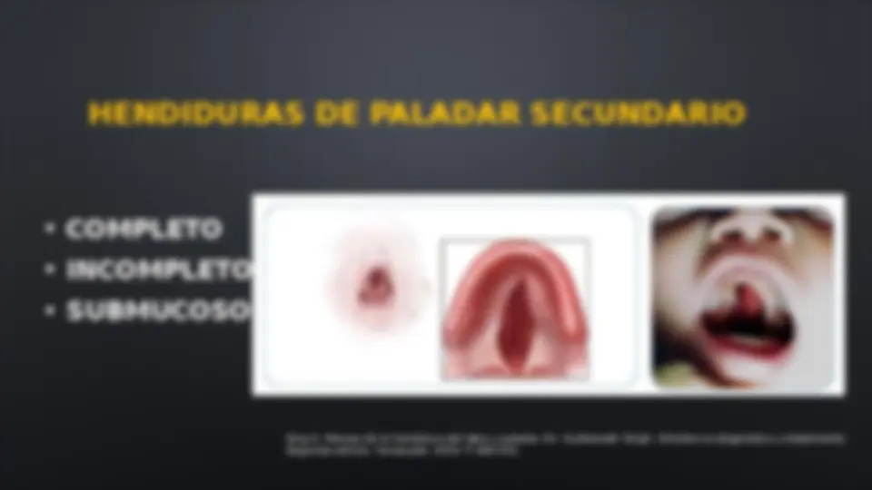 pfe