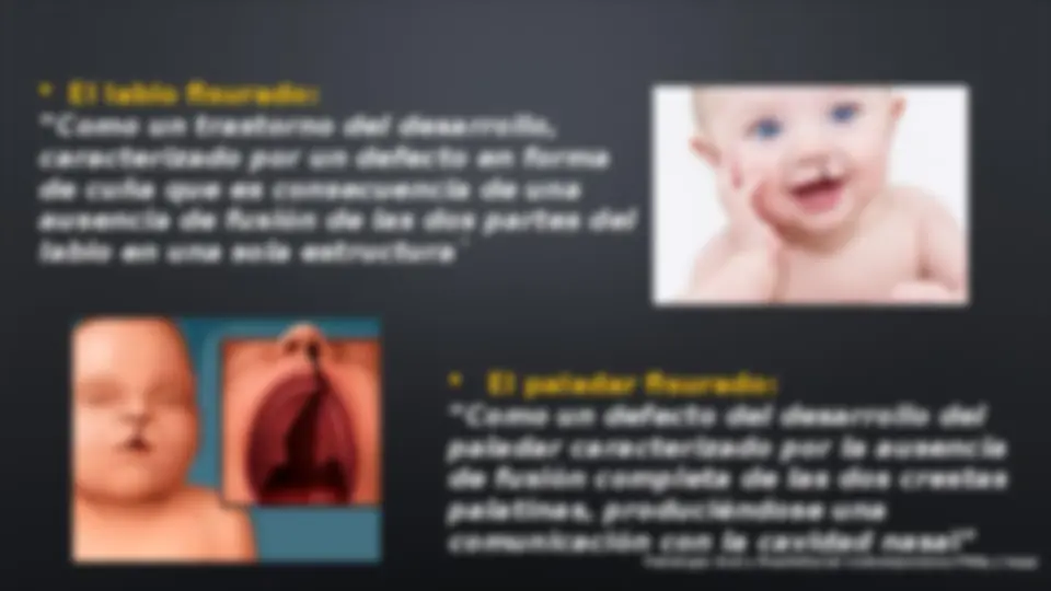 pf4