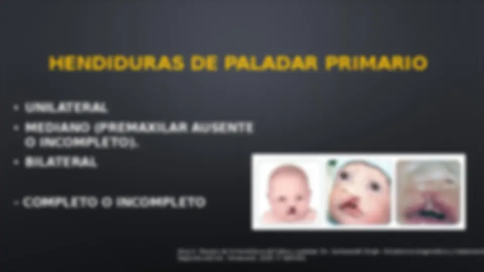 pfd