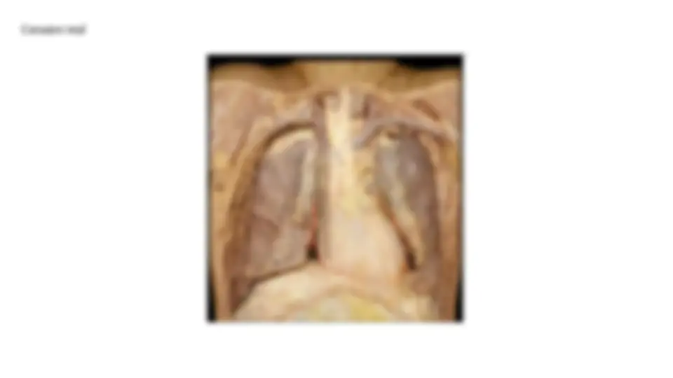 pf5