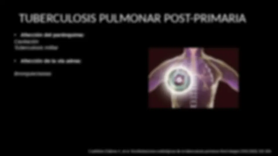 pf16
