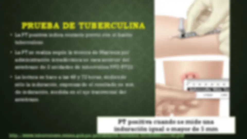 pf2e