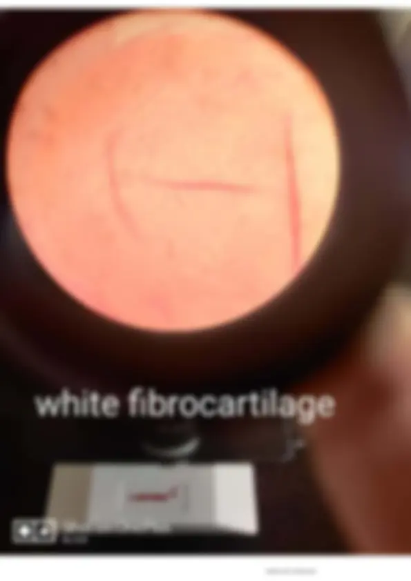 pf39