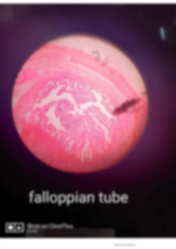pfe