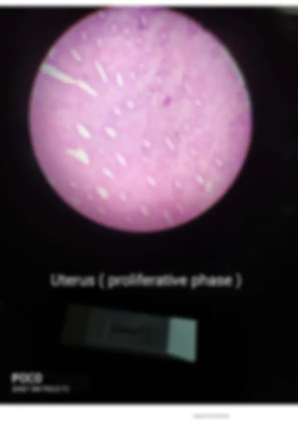 pf3c