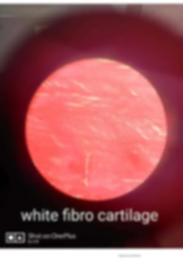 pf24