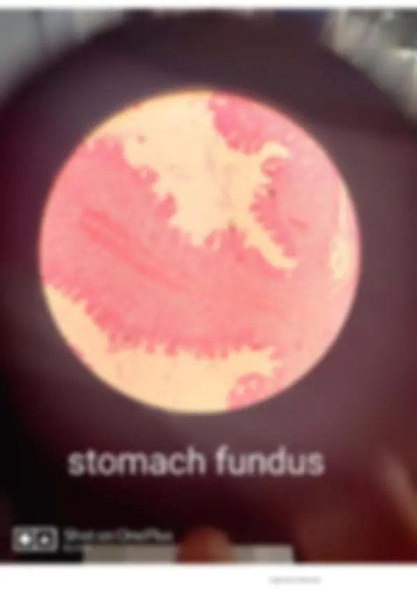 pf15
