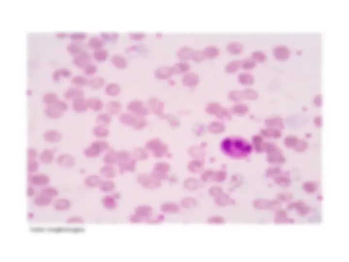 pf1f