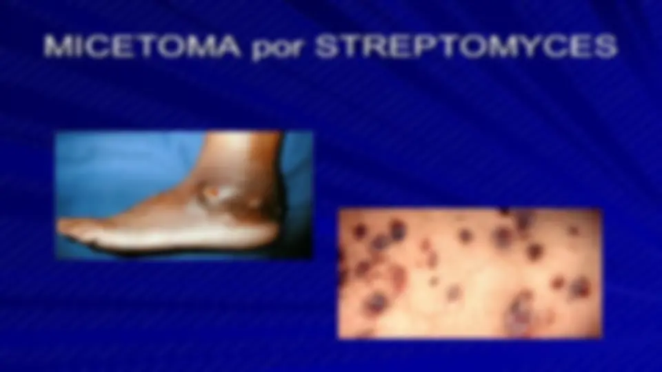 pf12