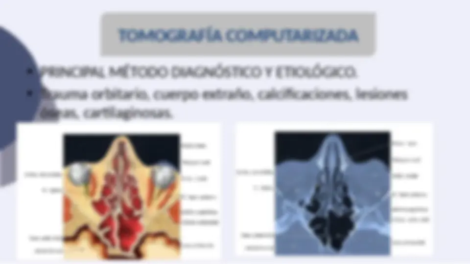 pfa