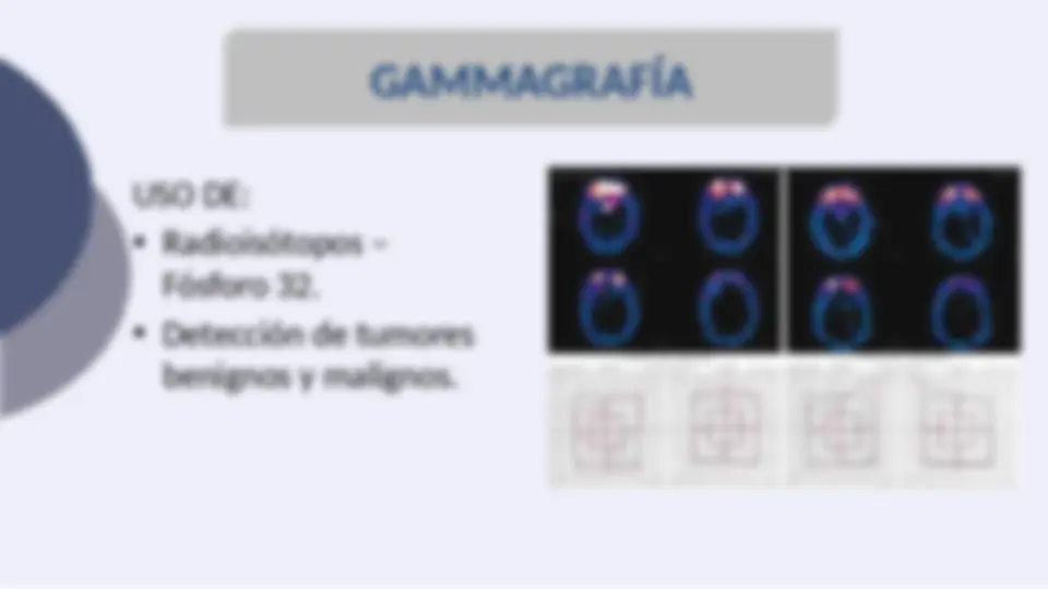 pfe