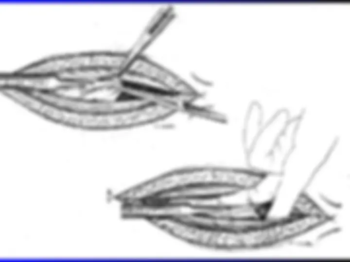 pf22