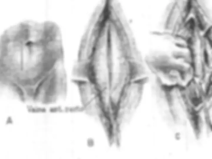 pf30
