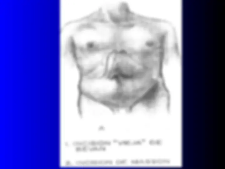 pf3b