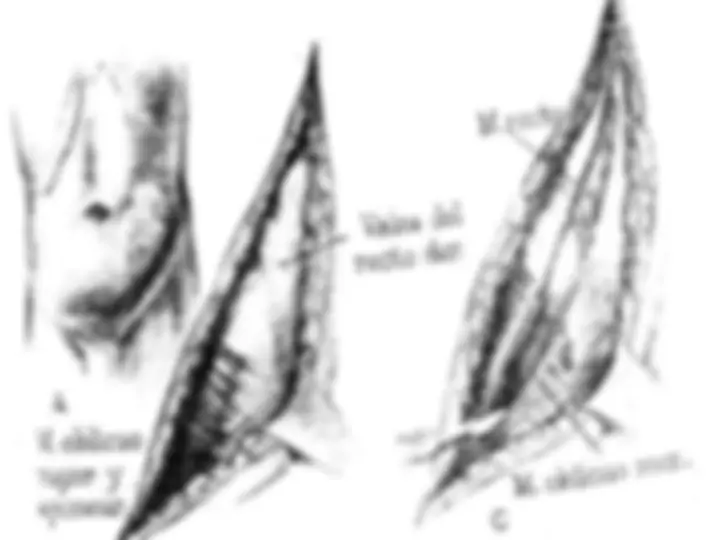 pf3a