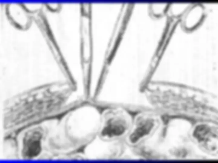 pf23