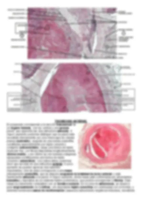 pfa