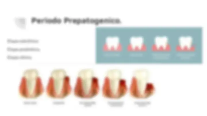 Static Caries Diagnostico de caries, lesiones pulpares y periodontales ...