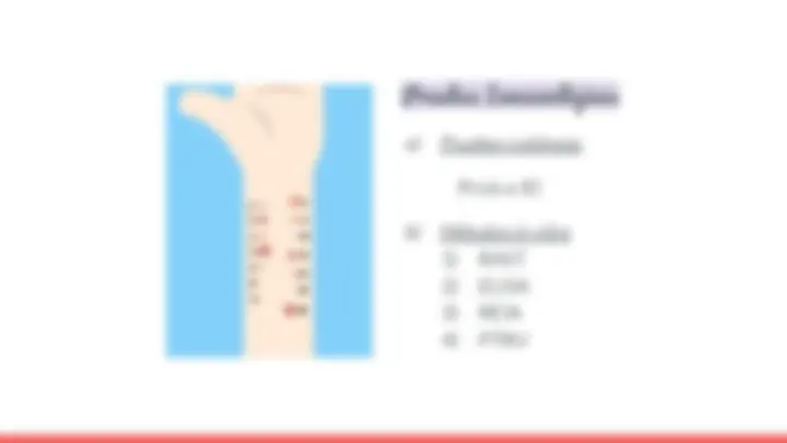 pfd