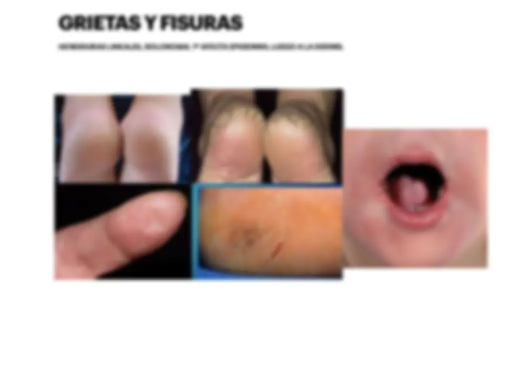 pf16
