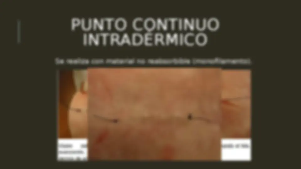 pf20