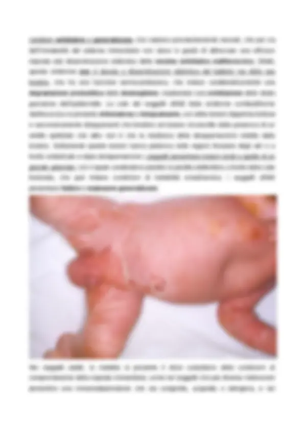 pfa