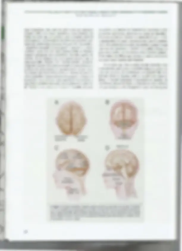pfa