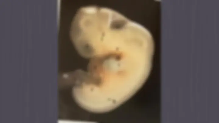 pf3a