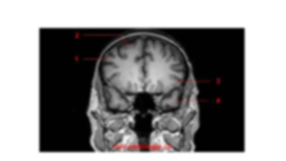 pf1d