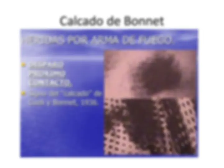 pfa